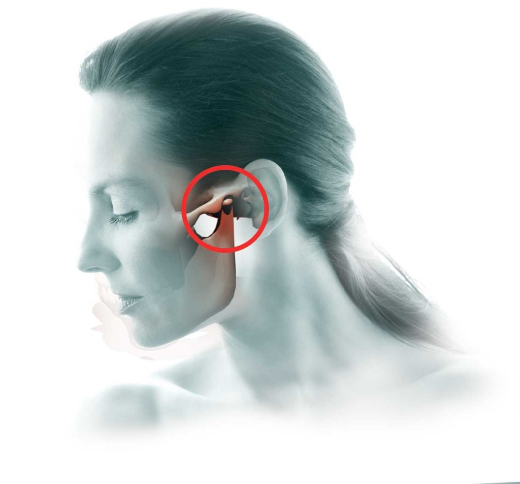 TMJ Syndrome, Jaw Pain, Chiropractor Donaghadee